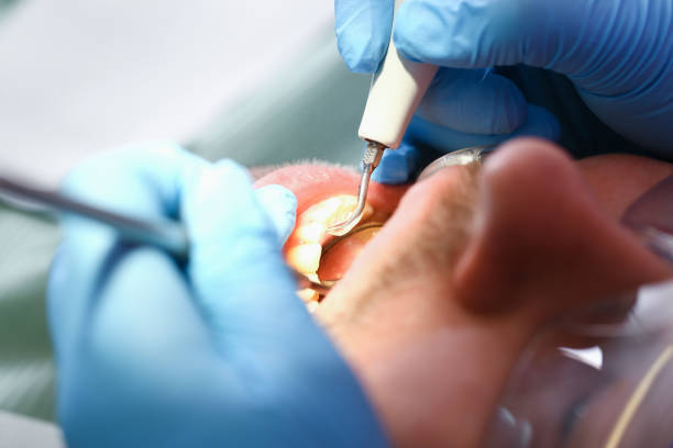 Best Emergency Dentist for Lost Fillings or Crowns in Cross Mountain, TX