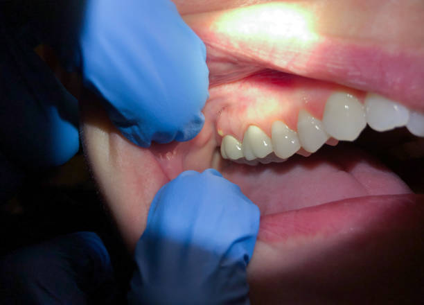 Best Pediatric Emergency Dentist in Cross Mountain, TX
