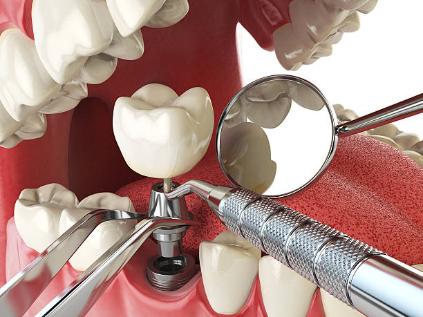 Best Pediatric Emergency Dentist in Cross Mountain, TX